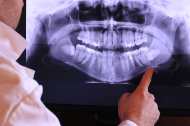 Best Tooth Infection Emergency Dentist  in Colby, KS