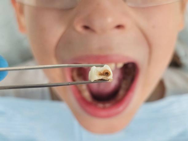 Best Emergency Gum Pain Relief  in Colby, KS